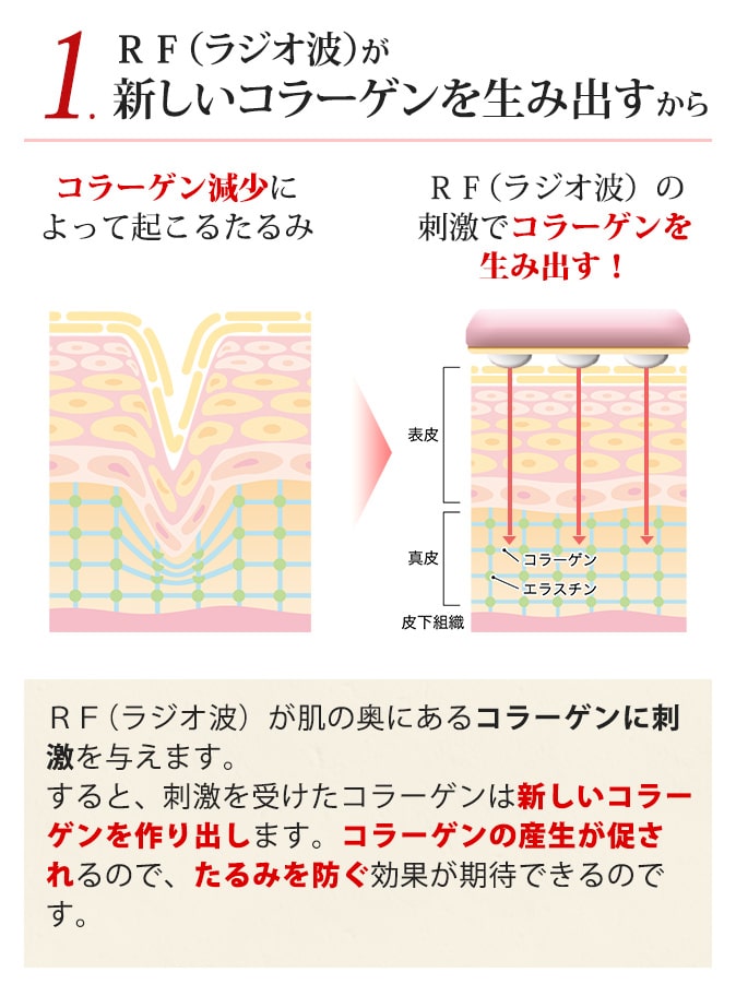 1.RF（ラジオ波）が新しいコラーゲンを生み出すから
